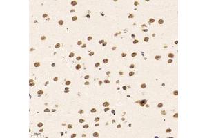 Immunohistochemistry of paraffin embedded mouse brain using SUPT3H (ABIN7075767) at dilution of 1: 1500 (400x lens) (SUPT3H/SPT3 antibody)