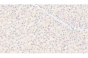 Detection of a2PI in Human Liver Tissue using Monoclonal Antibody to Alpha 2-Antiplasmin (a2PI) (alpha 2 Antiplasmin antibody)