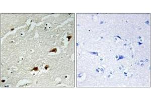 Immunohistochemistry analysis of paraffin-embedded human brain tissue, using NF-kappaB p65 (Ab-529) Antibody. (NF-kB p65 antibody  (AA 496-545))