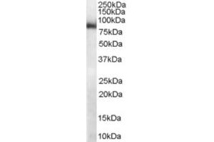 Western Blotting (WB) image for anti-Midline 2 (MID2) (C-Term) antibody (ABIN2465946) (Midline 2 antibody  (C-Term))