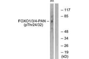 Western blot analysis of extracts from 293 cells treated with Serum 20% 15', using FOXO1/3/4-pan (Phospho-Thr24/32) Antibody. (FOXO1 antibody  (pThr24))