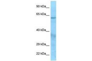 Image no. 1 for anti-Complement Factor I (CFI) (AA 145-194) antibody (ABIN6748298) (Complement Factor I antibody  (AA 145-194))