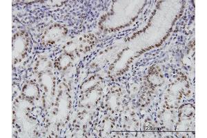 Immunoperoxidase of monoclonal antibody to BRD3 on formalin-fixed paraffin-embedded human stomach. (BRD3 antibody  (AA 418-556))