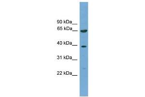 WB Suggested Anti-KLHL20  Antibody Titration: 0. (KLHL20 antibody  (C-Term))