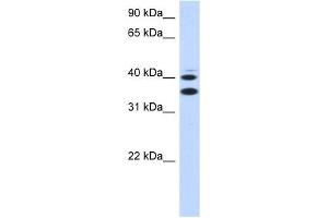 SLC25A32 antibody used at 1 ug/ml to detect target protein. (SLC25A32 antibody  (Middle Region))