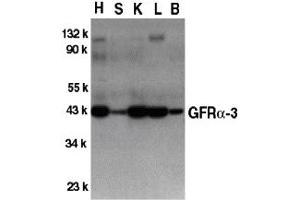 Western Blotting (WB) image for anti-GDNF Family Receptor alpha 3 (GFRA3) (Middle Region) antibody (ABIN1030939) (GFRA3 antibody  (Middle Region))