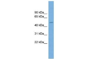 WB Suggested Anti-TRIM49 Antibody Titration: 0. (TRIM49 antibody  (Middle Region))