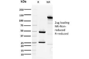 SDS-PAGE Analysis Purified ORC1 Mouse Monoclonal Antibody (7F6/1).