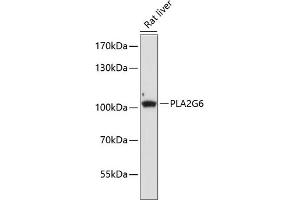 Western blot analysis of extracts of rat liver, using PLG6 antibody (ABIN6134886, ABIN6145732, ABIN6145733 and ABIN6225021) at 1:1000 dilution. (PLA2G6 antibody  (AA 550-650))