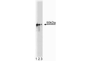 Western blot analysis of Dynactin p50 on Jurkat cell lysate. (Dynamitin antibody  (AA 55-196))