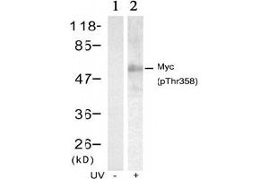 Image no. 2 for anti-Myc Proto-Oncogene protein (MYC) (pThr358) antibody (ABIN196675) (c-MYC antibody  (pThr358))