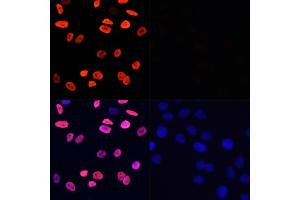 Immunofluorescence analysis of HeLa cells using Acetyl-Histone H3-K9 antibody (ABIN7267675) at dilution of 1:100 (40x lens). (Histone 3 antibody  (H3K9))