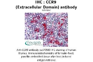 Image no. 1 for anti-Chemokine (C-C Motif) Receptor 9 (CCR9) (2nd Extracellular Domain) antibody (ABIN1732788) (CCR9 antibody  (2nd Extracellular Domain))