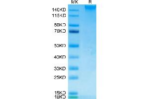SEZ6 Protein (AA 20-925) (His tag)