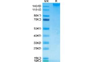 Human SEZ6 on Tris-Bis PAGE under reduced condition. (SEZ6 Protein (AA 20-925) (His tag))