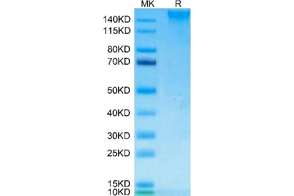 SEZ6 Protein (AA 20-925) (His tag)