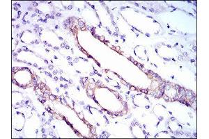 Immunohistochemistry (IHC) image for anti-Ribosomal Protein L18a (RPL18A) (AA 50-176) antibody (ABIN2983307) (RPL18A antibody  (AA 50-176))