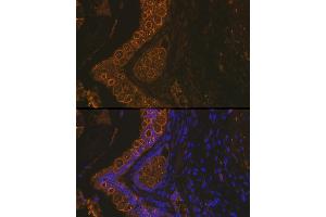 Immunofluorescence analysis of Rat rectum using Cytokeratin 18 (KRT18) antibody (ABIN7268097) at dilution of 1:100. (Cytokeratin 18 antibody)