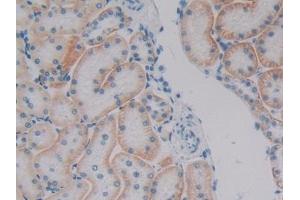 DAB staining on IHC-P; Samples: Human Kidney Tissue (Plakophilin 1 antibody  (AA 500-742))