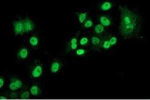 Anti-LOX mouse monoclonal antibody (ABIN2453810) immunofluorescent staining of COS7 cells transiently transfected by pCMV6-ENTRY LOX (RC213323).