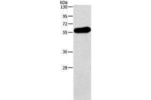 Western Blot analysis of Human testis tissue using APOH Polyclonal Antibody at dilution of 1:275 (APOH antibody)