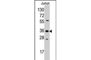 Western blot analysis of AKR1B1 polyclonal antibody  in Jurkat cell line lysates (35 ug/lane). (AKR1B1 antibody  (Internal Region))