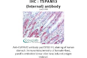 Image no. 2 for anti-Tetraspanin 13 (TSPAN13) (Internal Region) antibody (ABIN1740424) (TSPAN13 antibody  (Internal Region))