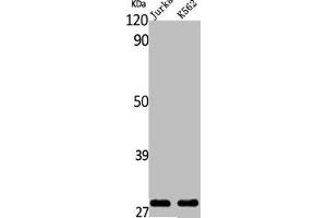 Western Blot analysis of Jurkat K562 cells using ING4 Polyclonal Antibody