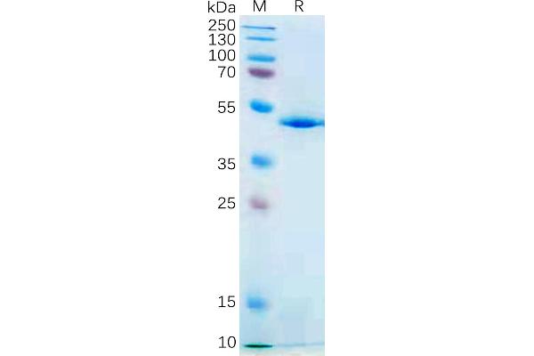 IL-21 Protein (AA 30-162) (Fc Tag)