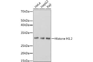 Western blot analysis of extracts of various cell lines, using Histone H1. (HIST1H1C antibody)