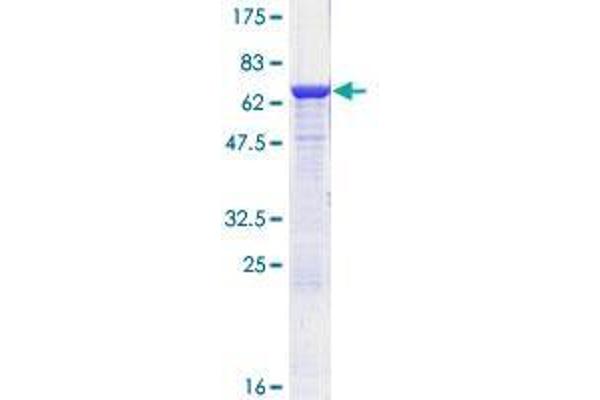 ADH1C Protein (AA 1-375) (GST tag)