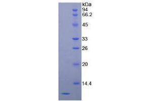 SDS-PAGE analysis of Human SCCA2 Protein. (SERPINB4 Protein)