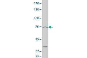 KAL1 polyclonal antibody (A01), Lot # ABNOVA060629QCS1 Western Blot analysis of KAL1 expression in Hela S3 NE . (KAL1 antibody  (AA 548-657))