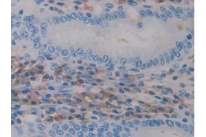 Immunohistochemistry (IHC) image for anti-ADAM Metallopeptidase Domain 10 (ADAM10) (AA 420-641) antibody (ABIN7432559)