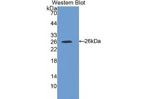 Western Blotting (WB) image for anti-Suppressor of Cytokine Signaling 3 (SOCS3) (AA 1-225) antibody (ABIN3206237) (SOCS3 antibody  (AA 1-225))