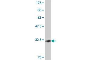 Western Blot detection against Immunogen (34. (CD3D antibody  (AA 22-100))