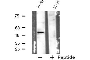 Western blot analysis of extracts from HT-29 cells, using ADRB1 antibody. (ADRB1 antibody  (Internal Region))