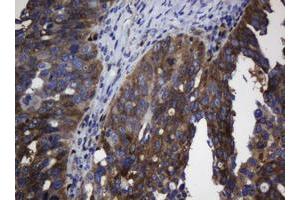 Image no. 1 for anti-TSC22 Domain Family, Member 1 (TSC22D1) antibody (ABIN1501537) (TSC22D1 antibody)