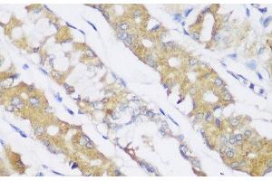 Immunohistochemistry of paraffin-embedded Human stomach using FA2H Polyclonal Antibody at dilution of 1:150 (40x lens). (FA2H antibody)