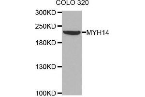 Western blot analysis of extracts of COLO320 cell line, using MYH14 antibody. (Myosin antibody)