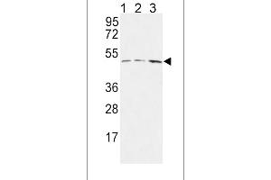 HLN1 Antibody (N-term) 9791a western blot analysis in MCF-7(lane 1),Jurkat(lane 2),HepG2(lane 3) cell line lysates (35 μg/lane). (HAPLN1 antibody  (N-Term))