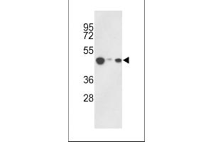 Western blot analysis of hHAT1-E404 in 293, HepG2, Jurkat cell line lysates (35ug/lane) (HAT1 antibody  (C-Term))