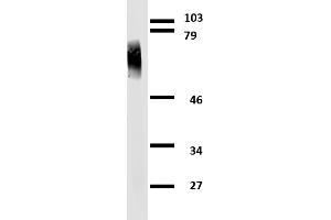 Western blotting analysis of human clusterin using mouse monoclonal antibody Hs-3 on lysates of MCF-7 cell line and MOLT-4 cell line (clusterin non-expressing cell line, negative control) under non-reducing and reducing conditions. (Clusterin antibody)