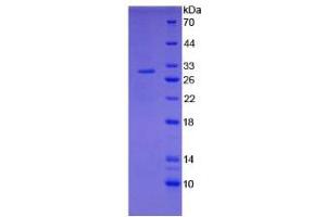 SDS-PAGE analysis of Rat Tissue Factor Protein.