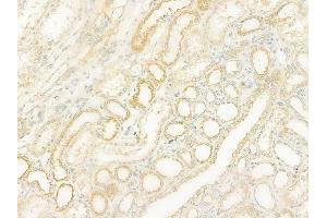 ABIN6265572 and ABIN6273080 at 1/100 staining human normal kidney tissue by IHC-P.