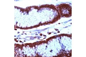 Immunohistochemistry (IHC) image for anti-Baculoviral IAP Repeat-Containing 5 (BIRC5) (N-Term) antibody (ABIN4369171) (Survivin antibody  (N-Term))