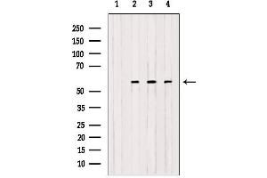 OXCT1 antibody  (Internal Region)