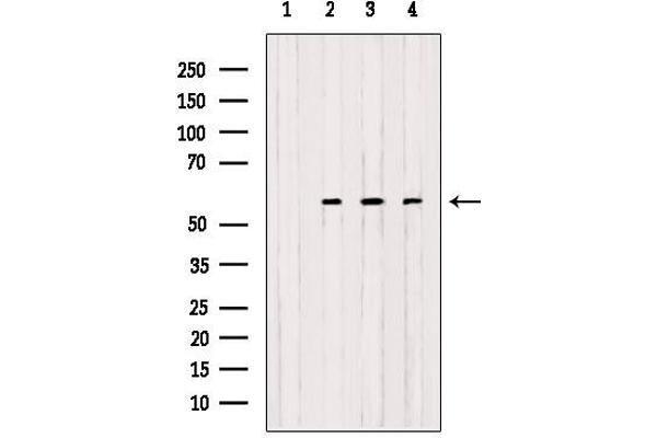 OXCT1 antibody  (Internal Region)