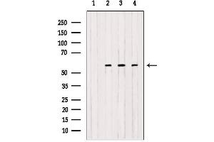 Western blot analysis of extracts from various samples, using OXCT1 antibody.