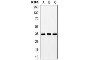 Western blot analysis of GPR171 expression in HEK293T (A), mouse liver (B), rat liver (C) whole cell lysates.